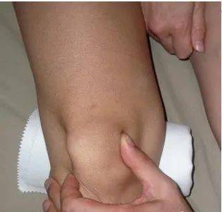 体股是什么意思(体股廯的症状图片)